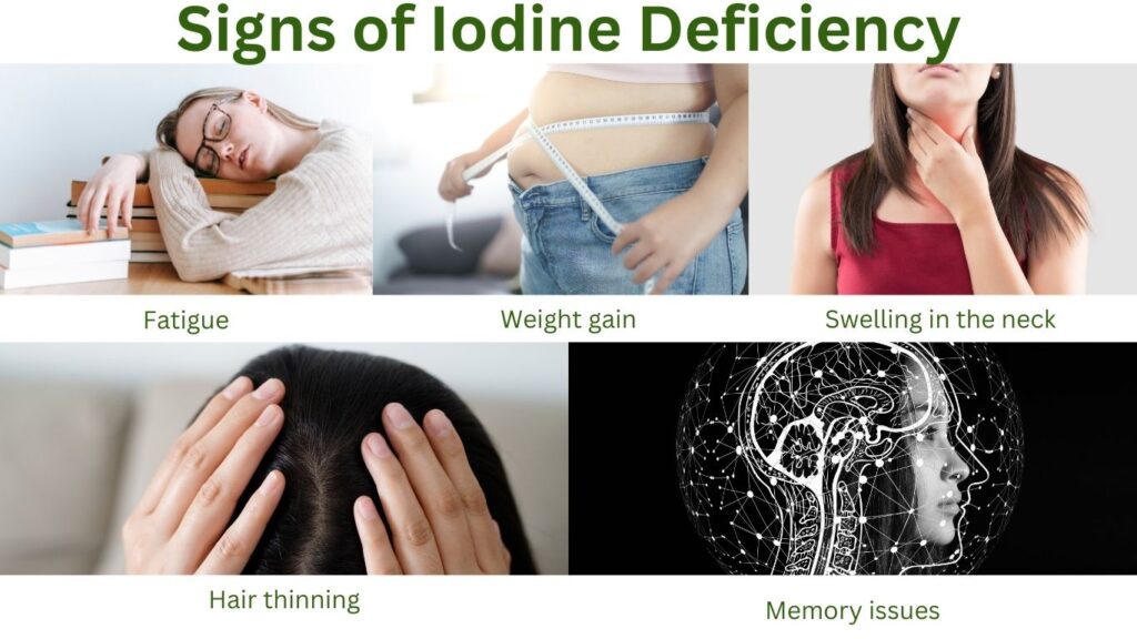 Signs of Iodine Deficiency